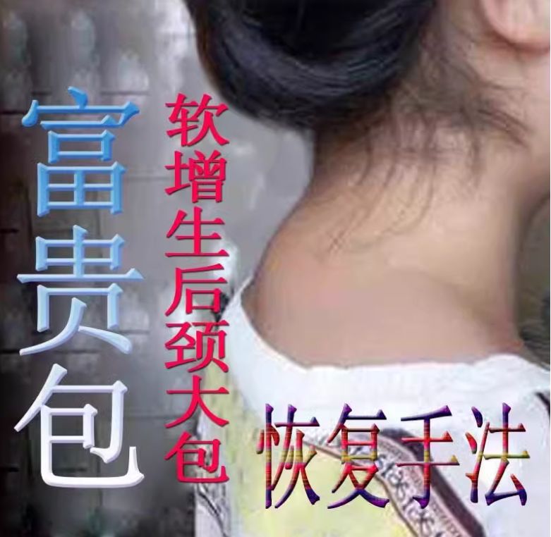 颈后大包(富贵包)处理手法视频教程-中医免费自学网